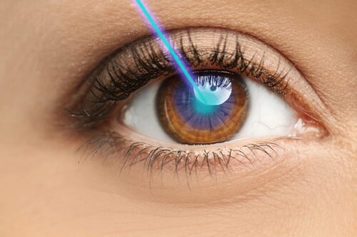 Uzak, Yakın, Astigmat, Miyop, Hipermetrop, Keratokonus, Keratoconus, Lazer Göz Ameliyatı, LASIK, LASEK, PRK, T-PRK, No-Touch, Lazer Göz, Göz Hastanesi, Laser Eye Surgery, Laser Eye Surgeries, All about Laser Eye Surgery, What is the risk of laser eye surgery