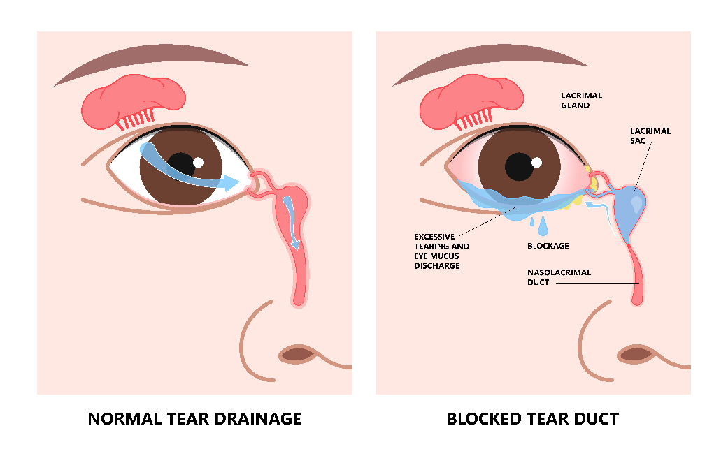 How Tears Work  National Eye Institute