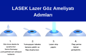 LASEK Lazer göz ameliyatı, LASIK, Lazer, Laser, Göz Ameliyatı, Göz Çizdirme, Göz Çizdirme Ameliyatı, Lazer ile göz çizdirme ameliyatları, Lazer Göz Ameliyatı Adımları, LASEK Lazer göz ameliyatı nasıl yapılır, LASEK Lazer göz ameliyatları hakkında, Uzak, Yakın, Astigmat, Hipermetrop, Mitop, Presbiyopi