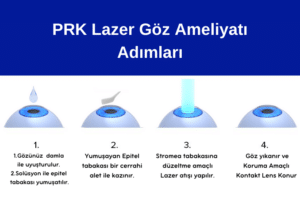 PRK Lazer göz ameliyatı, PRK, Lazer, Laser, Göz Ameliyatı, Göz Çizdirme, Göz Çizdirme Ameliyatı, Lazer ile göz çizdirme ameliyatları, Lazer Göz Ameliyatı Adımları, PRK Lazer göz ameliyatı nasıl yapılır, PRK Lazer göz ameliyatları hakkında, Uzak, Yakın, Astigmat, Hipermetrop, Miyop, Presbiyopi