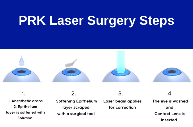 PRK Laser Surgery