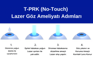 TransEpiteliyal-PRK, No Touch Lazer göz ameliyatı, No Touch Lazer, No Touch Laser, No Touch Lazer göz ameliyatı, No-Touch Lazer, No-Touch Laser, Göz Ameliyatı, Göz Çizdirme, Göz Çizdirme Ameliyatı, NoTouch Lazer ile göz çizdirme ameliyatları, NoTouch Lazer Göz Ameliyatı Adımları, LASIK Lazer göz ameliyatı nasıl yapılır, NoTouch Lazer göz ameliyatları hakkında, Uzak, Yakın, Astigmat, Hipermetrop, Miyop, Presbiyopi