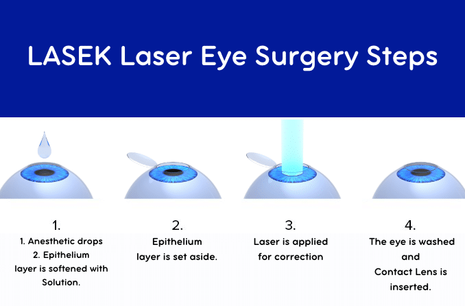 LASEK Laser eye surgery steps