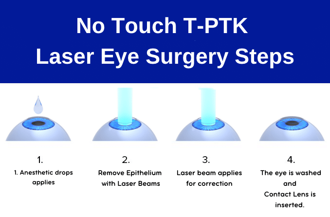 No touch laser eye surgery, No touch, T-PRK